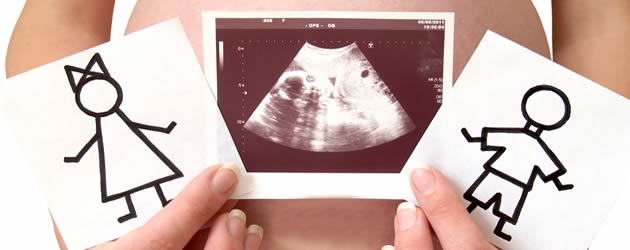 spol bebe trudnoca